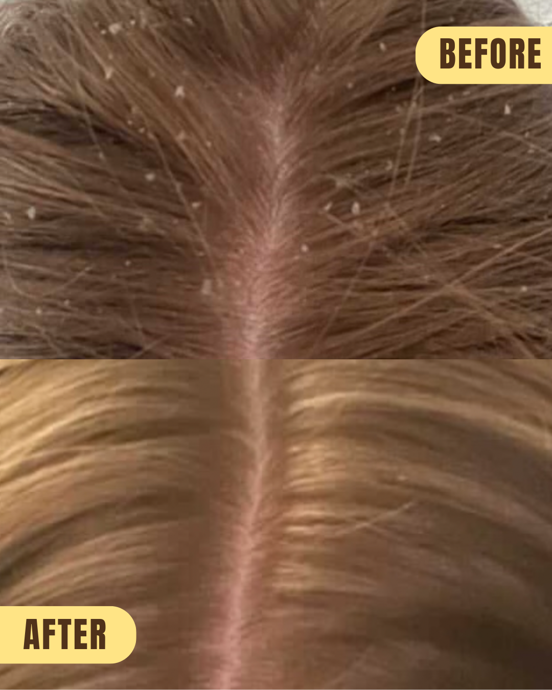 MINT CONDITION - for a flaky, itchy scalp