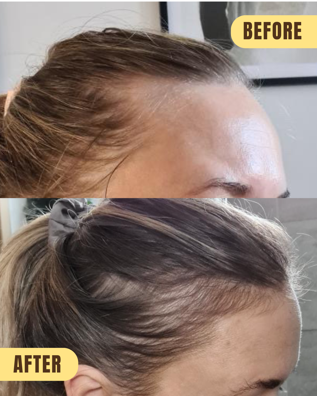GROWSMARY - for thinning, sparse hair